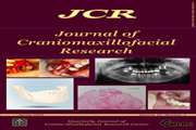 Reconstruction of alveolar defects with regenerative properties of adipose-derived stem cells